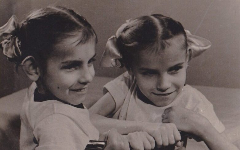 Как сложилась судьба первых сиамских близнецов в СССР